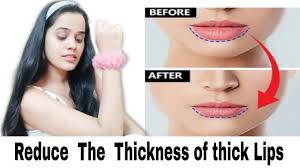 fat lip to thinner lips naturally