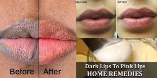 9 home remes to treat dark lips