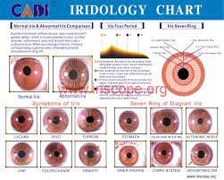 How To Read Iridology Eye Charts Iriscope Iridology