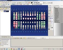 Justin Shafer How To Bring Back Missing Dentrix Image X Rays
