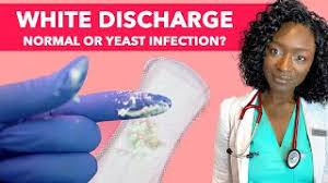 how to stop inal yeast infection