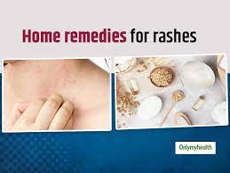 want to treat rashes on skin here are