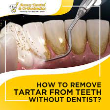 how to remove tartar from teeth without