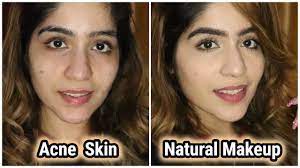 no makeup makeup look for acne skin