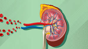 chronic kidney disease