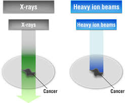 heavy ion radiotherapy