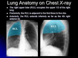 Conclusion of living anatomy of the chest congratulations! Chest Radiography Interpretation Ppt Video Online Download