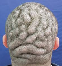 scalp look like surface of brain
