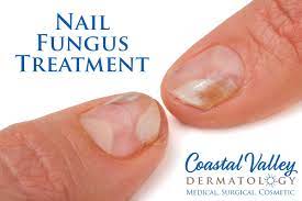 nail fungus coastal valley dermatology