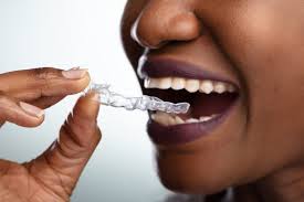 Some people's teeth grow uneven. Orthodontic Treatment Without Braces Penn Dental Family Practice