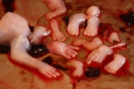 Image result for aborted baby parts pictures