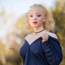 Image result for beautiful albinos