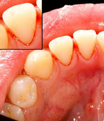 periodontist what is the best and 1