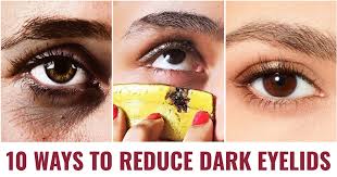 how to treat dark eyelids