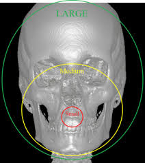 cone beam computed tomography dental