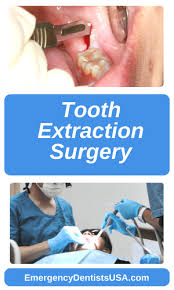 Unfortunately, this is also the most complicated situation. Emergency Tooth Extraction Near Me 24 7 No Insurance Ok