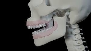 If you have braces, loop your rubber bands onto the little hooks on your braces to connect the upper jaw to the bottom. Malocclusion Of Teeth And How Elastic Bands Help Correct It