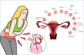 dysmenorrhea or menstrual pain healiving