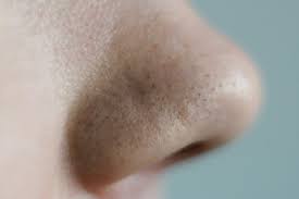 In fact, hair follicles have lots of responsibilities. How To Get Rid Of Blackheads On Your Nose