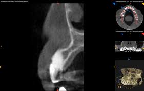 why cbct cone beam ct scan is a must