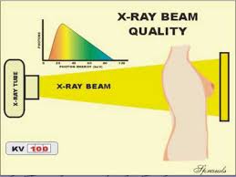 x ray image formation and contrast