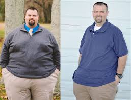 gastric sleeve 10 years later all you