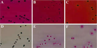 H₂s indicator system in xld agar. Development Of An Improved Selective And Differential Medium For Isolation Of Salmonella Spp Journal Of Clinical Microbiology