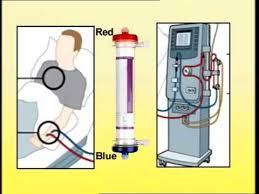 setting up of dialysis machine you