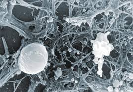 La apoptosis es una ruta fisiológica de muerte celular por múltiples estímulos acompáñame a comprender este breve esquema de las distintas formas de activar. Apoptosi Cellulare Biopills