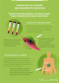 herniated disc recovery time cellaxys