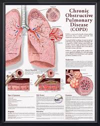 Chronic Obstructive Pulmonary Disease Copd Chart 20x26