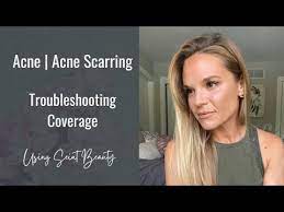 acne acne scarring troubleshooting