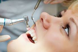 what is prophylaxis dental cleaning