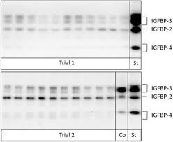 Frontiers Increased Concentrations Of Insulin Like Growth