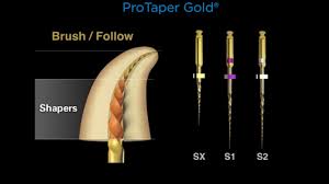 Canal Preparation With Protaper Gold