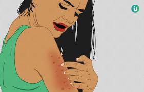 skin rash symptoms causes treatment