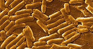 Salmonella bacteria typically live in animal and human intestines and are shed through feces. Infecoes Por Salmonella Cuf