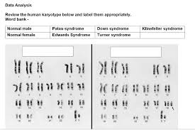 Maybe you would like to learn more about one of these? Data Analysis Review The Human Karyotype Below And Chegg Com