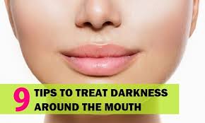 remove darkness around mouth and lips