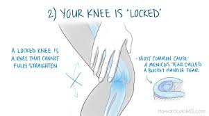 is my knee injury serious 5 signs to