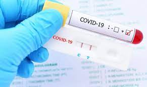What is now sort of evolving into a bit of a standard… if you get a cycle threshold of 35 or more … the chances of it. Pcr Covid Testing To Travel To Europe Latest Updates