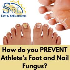 foot and nail fungus