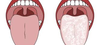 what your tongue appearance means for