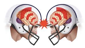 do helmets protect against concussion