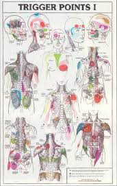 Risultati immagini per trigger point mappa