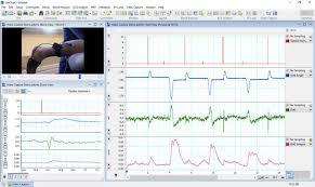 Labchart Life Science Data Acquisition And Analysis Software