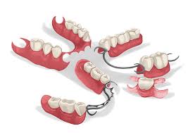 We provide the us free and free denture dentist clinic list. Dentures Types Partial Full And Average Cost Authority Dental