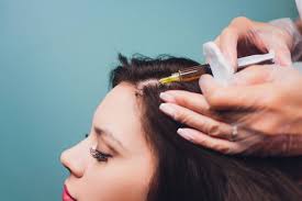 prp hair loss treatment for women