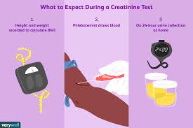 Creatinine Tests Uses Side Effects Procedure Results