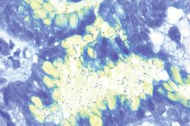 alcian yellow toluidine blue kit biognost